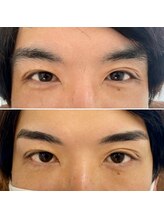 ベリル(Beryl)/メンズアイブロウ