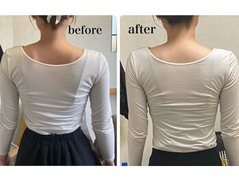 ディアンヌ(Diane)/背中/二の腕/巻き肩/首/ゆがみ