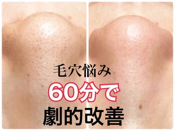 ピエル 北千住店(PIEL)/毛穴悩み60分で劇的改善