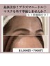 【刺さない針★】プラズマシャワー+ヒト幹細胞美容液¥1１,000→¥7,000