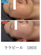 ユフラ(Juhla)/ララピール