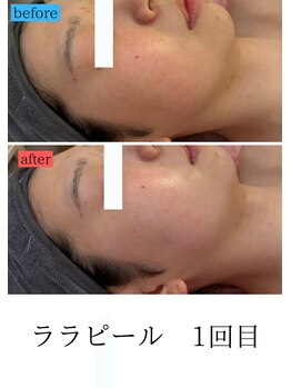 ユフラ(Juhla)/ララピール