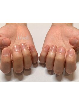 爪の悩みを解消できる（ケア含む）