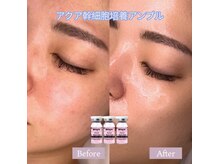 ソアン(Soin)/エステダーマ