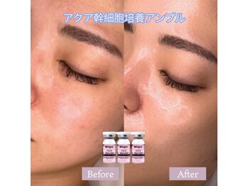 ソアン(Soin)/エステダーマ