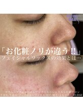 エリス(ELISSE)/フェイシャルワックスと光脱毛