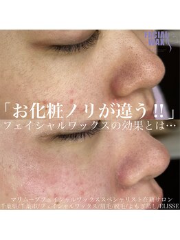 エリス(ELISSE)/フェイシャルワックスと光脱毛