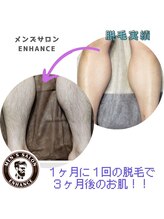 エンハンス 亀有(enhance)/脱毛実績