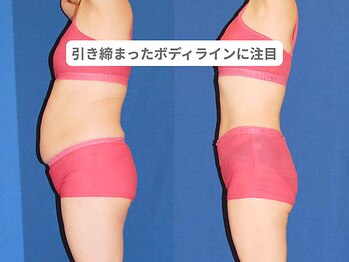 ピュアノア 垂水店/痩身ダイエット　神戸垂水明石