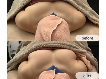 ルルミリ 心斎橋(Lulumili)/デコルテラインからバストアップ