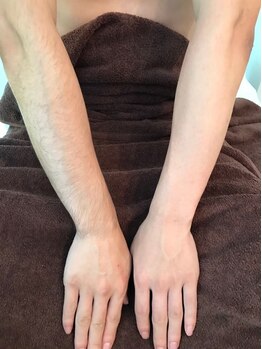 デリケート部分の脱毛/Vライン/VIO