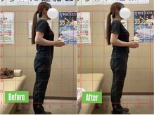 門司駅やわらぎ鍼灸整骨院/猫背矯正ビフォーアフター