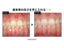 サロン エクラ(Salon E'clat)の雰囲気（回数を重ねるごとにさらに美しい口元へ♪）