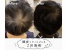 【自身を取り戻す】男女可能◎”本気の育毛促進" プロセルセラピーズ