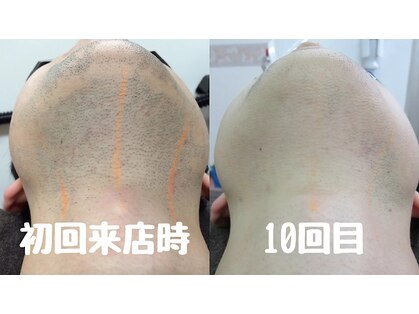 リムーブ(Re:move)の写真