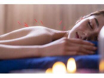 ハリーナ(HARI-NA)の写真/慢性的な首肩こり腰痛その場しのぎではなく根本改善したい方へ。鍼灸の力で深層の筋肉と自律神経を整える
