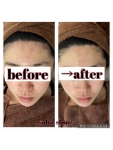 サロンシャイン(Salon Shine)/REVI顔の歪みも筋膜リリース