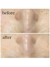 リボーン(Ribbo-n)/継続された結果♪