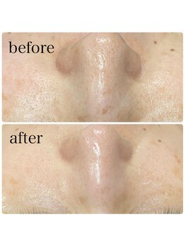 リボーン(Ribbo-n)/継続された結果♪