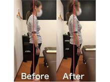 カワル整体 上通り院/【腰が痛いです…】