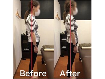 カワル整体 上通り院/【腰が痛いです…】