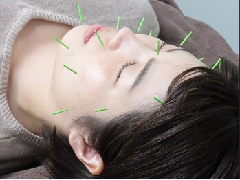 坂田鍼灸治療院/美容鍼水素吸入【板橋/新板橋】