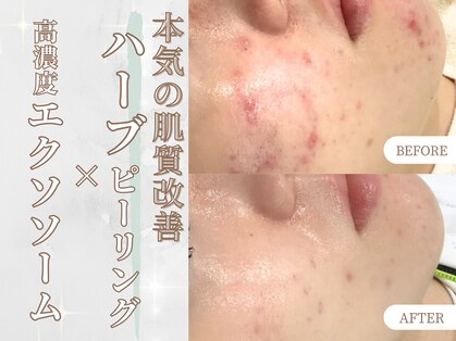 エクソ 吉祥寺(EXO)の写真
