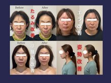 エレミュー 烏丸(Elemue.)/大人の小顔美人を多く輩出！！