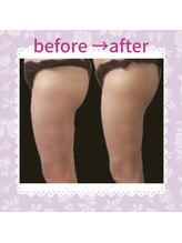 ビサイド(美side)/【痩身】