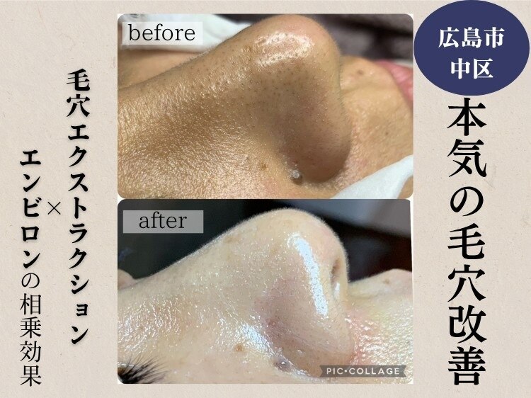 ジェンヌ(jenne.)｜ホットペッパービューティー