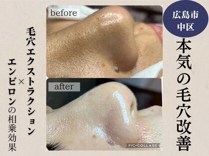 ジェンヌ(jenne.)の写真