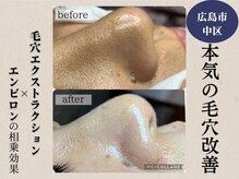 ジェンヌ(jenne.)