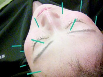 メグミ鍼灸治療院(Megumi鍼灸治療院)の写真/筋肉がほぐれ表情が豊かになるから好印象に◎むくみ改善/ハリツヤUPにも!憧れのフェイスラインをGETして♪