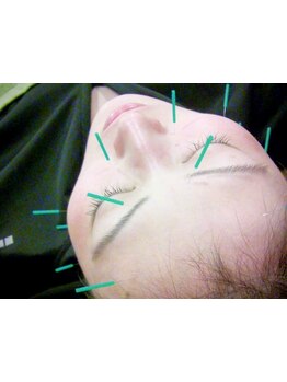 小顔になりたい