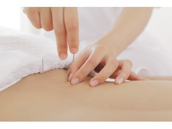 ほねつぎ つくば梅園はりきゅう接骨院