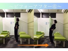 ケアるら整骨院 富里院/ビフォーアフター