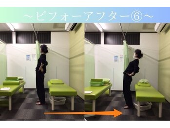 ケアるら整骨院 富里院/ビフォーアフター