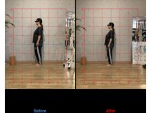 リード整骨院(LEAD整骨院)/姿勢改善、猫背、反り腰