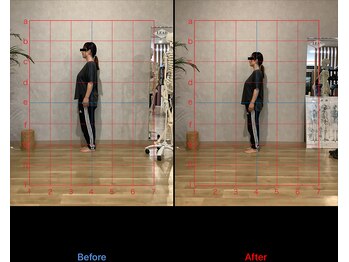 リード整骨院(LEAD整骨院)/姿勢改善、猫背、反り腰