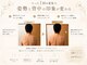 チャーム(charm.)の写真