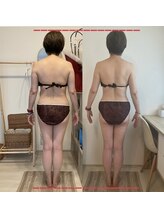 ビー肌スパ(Be肌スパ)/【50代お客様3ヶ月の変化】