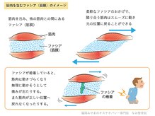 筋膜リリースで代謝アップ。痛みも軽減しスッキリ綺麗に整います