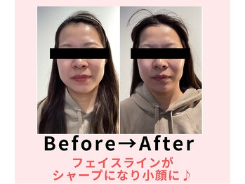 ココロ(COCORO)/美脳小顔矯正&毛穴洗浄