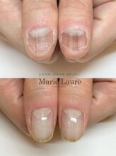 マリーロール 淀屋橋本店(Marie Laure)/深爪矯正/自爪育成/ネイルケア