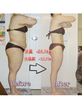 ボディグロス 梅田店(BODY GLOSS)/VIPセレブ2年ー26.7kg