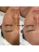 カーム(CALM.)/肌のトーンが一気にUP！