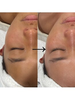 カーム(CALM.)/肌のトーンが一気にUP！