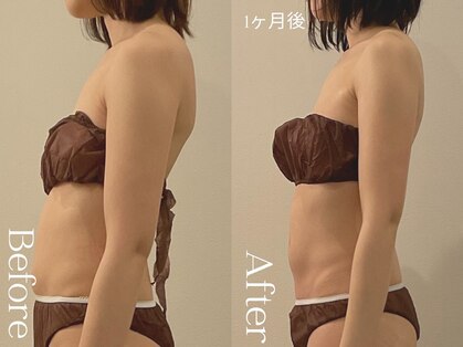 ユーフォリア グロウ(euphoria glow)の写真