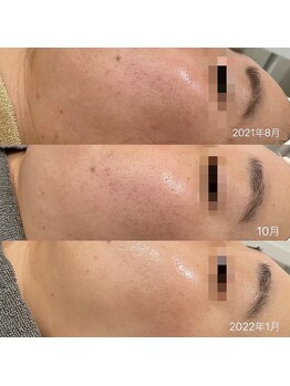 ラ クレール ビューティーサロン(LA CLAIR)/