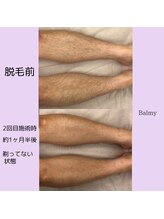 バルミー(Balmy)/ひざ下変身